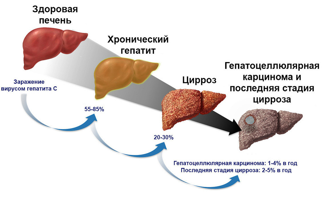 Неделя по борьбе с заражением и распространение хронического вирусного гепатита С 