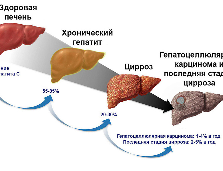 Неделя по борьбе с заражением и распространение хронического вирусного гепатита С 