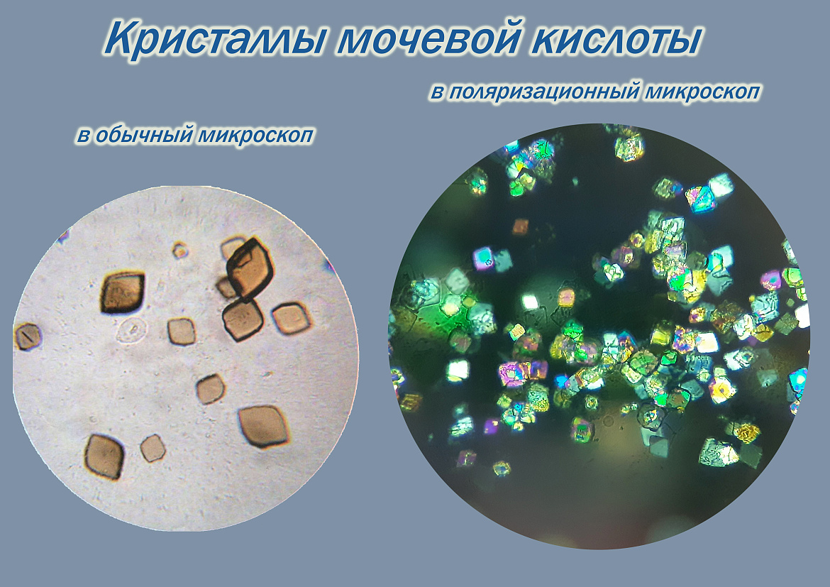 Новые возможности для диагностики заболеваний суставов