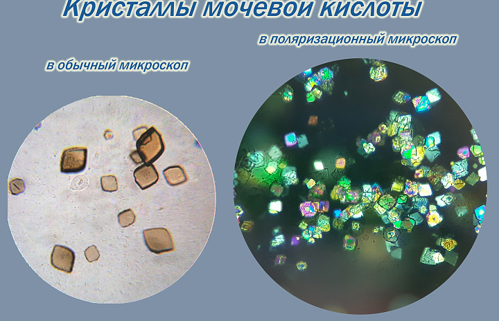 Новые возможности для диагностики заболеваний суставов