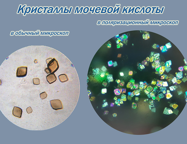 Новые возможности для диагностики заболеваний суставов