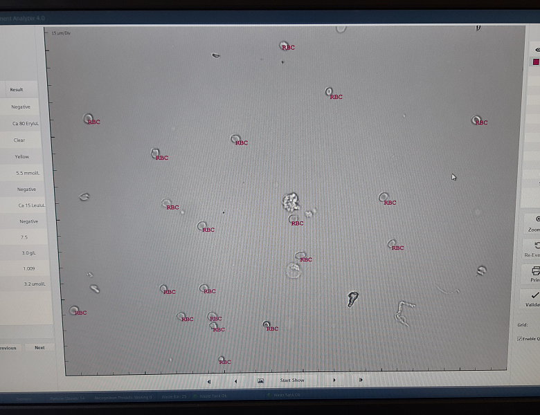 Клинический анализ мочи по-новому